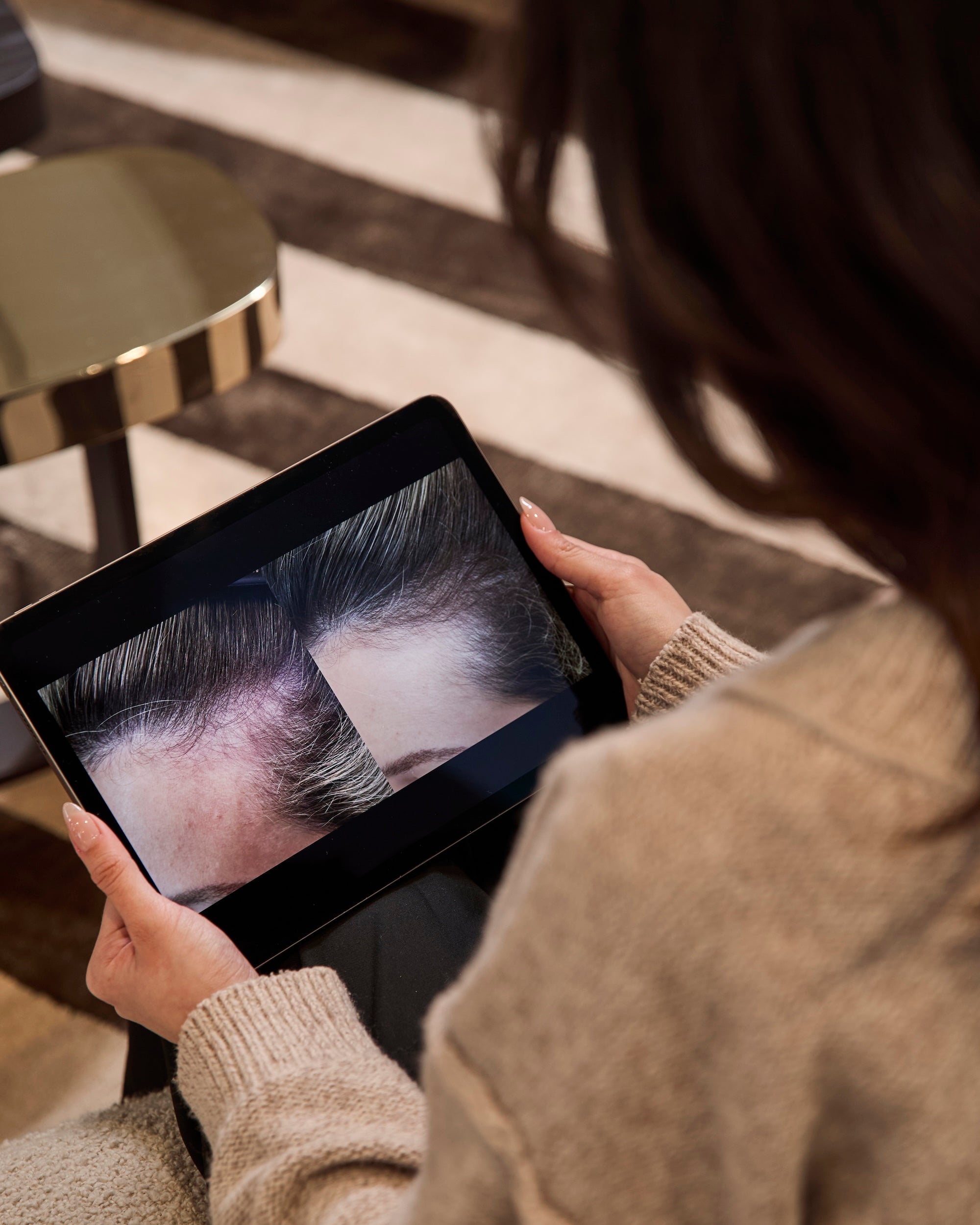 Effloressence : Et si l’on parlait enfin de perte de cheveux?